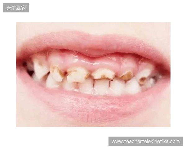 韦林顿确诊上唇部贯通伤；11、21牙半脱位；上颌前牙区牙槽骨骨折