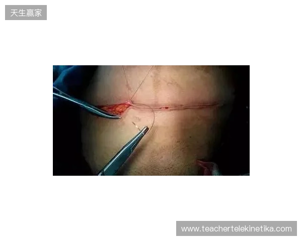 广州豹官方:杨浩眉弓伤口缝合30余针,预计5-7天后拆线 广州豹官方:杨浩眉弓伤口缝合30余针,预计5-7天后拆线